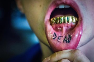 The Not-So-Cool Reality of Dental “Grills”
