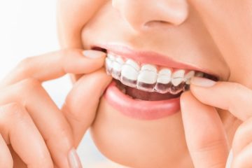 Three Things You Might Not Know About Wearing Invisalign Aligners